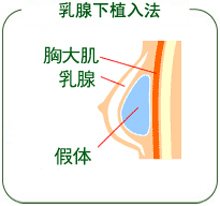 揭秘：明星美胸究竟怎么来的