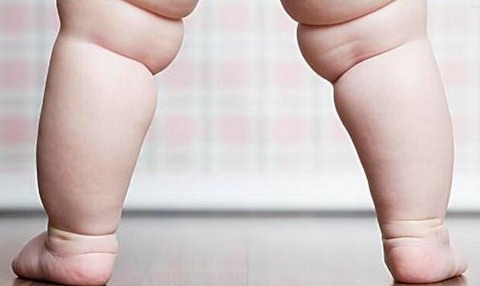 婴儿肥胖有哪些危害？如何预防婴儿肥胖？