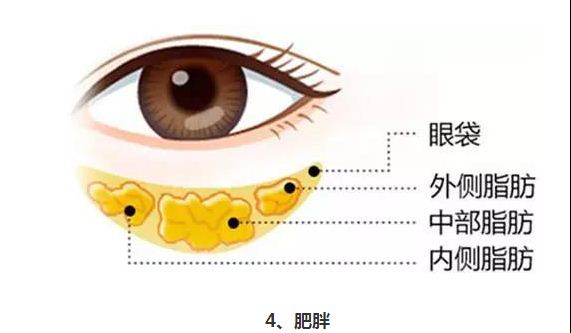 男子腹痛入院抽出两瓶黑血！竟是由于这个引起的！